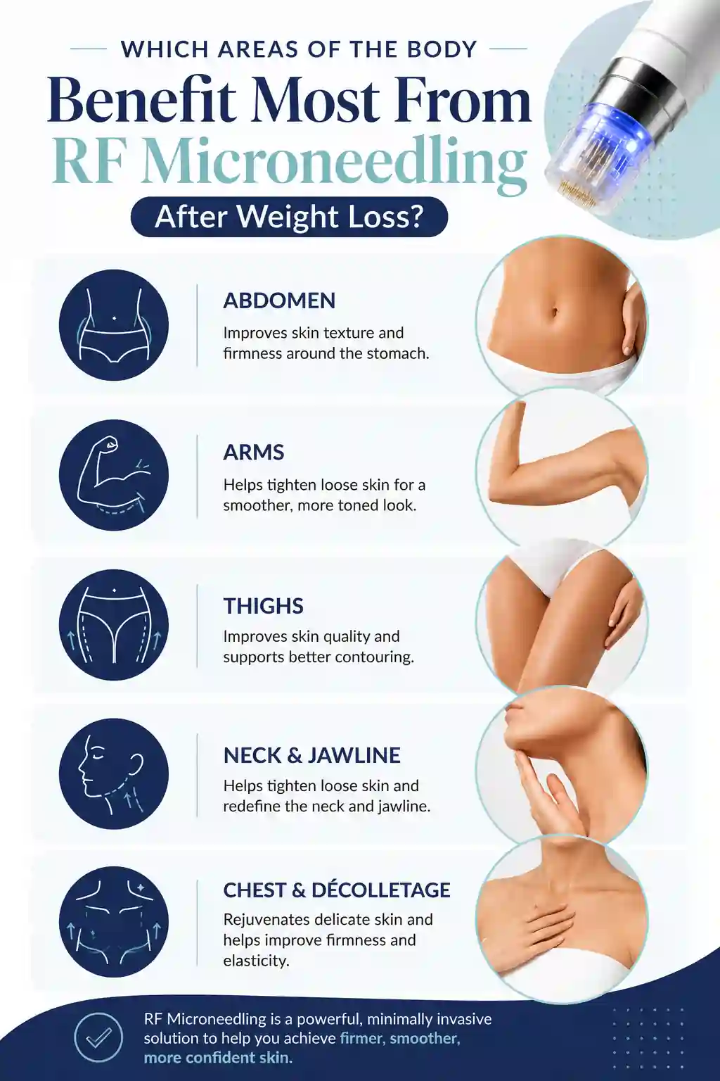 Which Areas of the Body Benefit Most From RF Microneedling After Weight Loss Bellshill